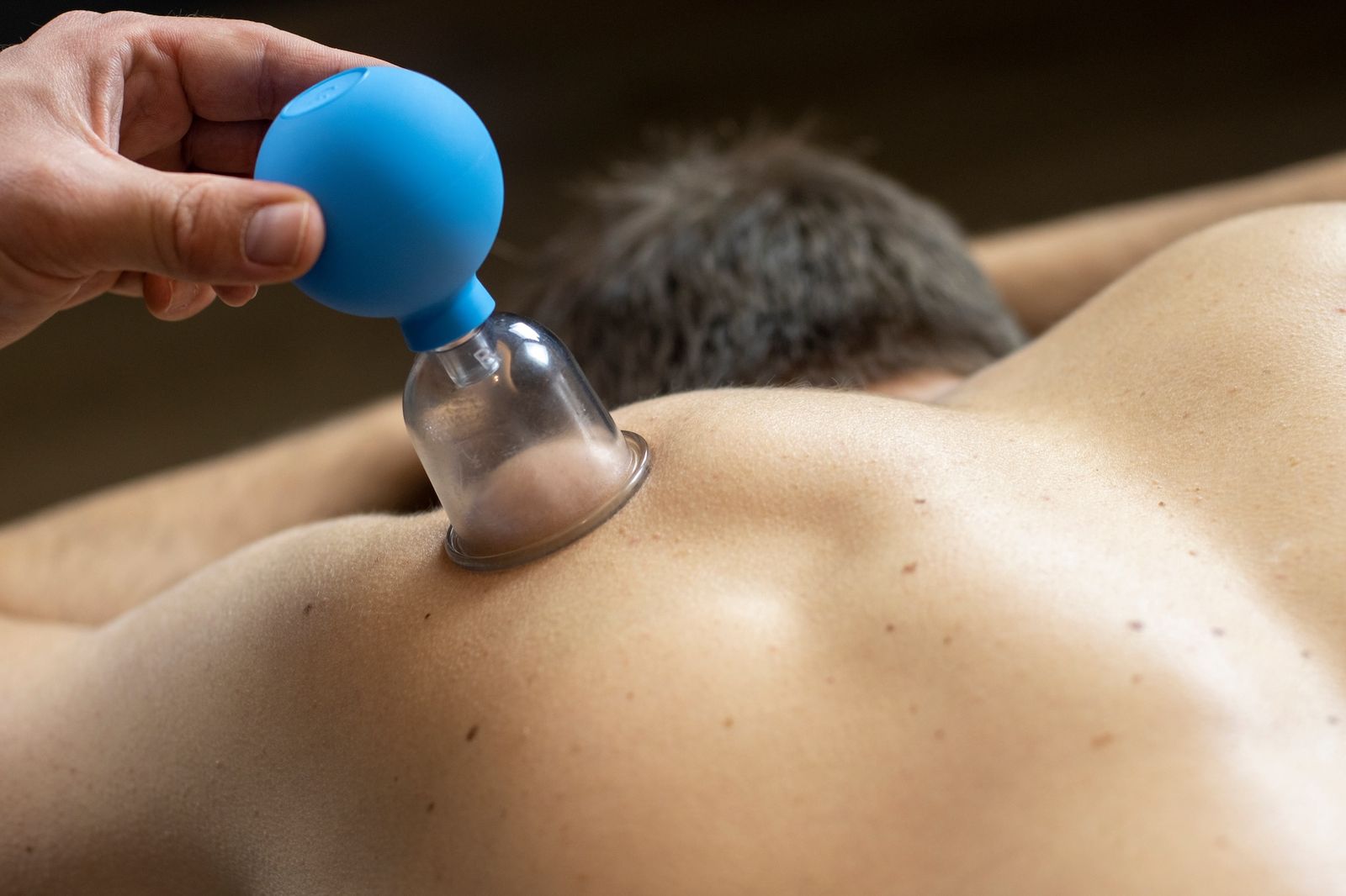 Entgiftende Schröpf Massage zur Stimulierung der Durchblutung mit Sauggläsern auf der Haut – bei QUAN in Lambsheim